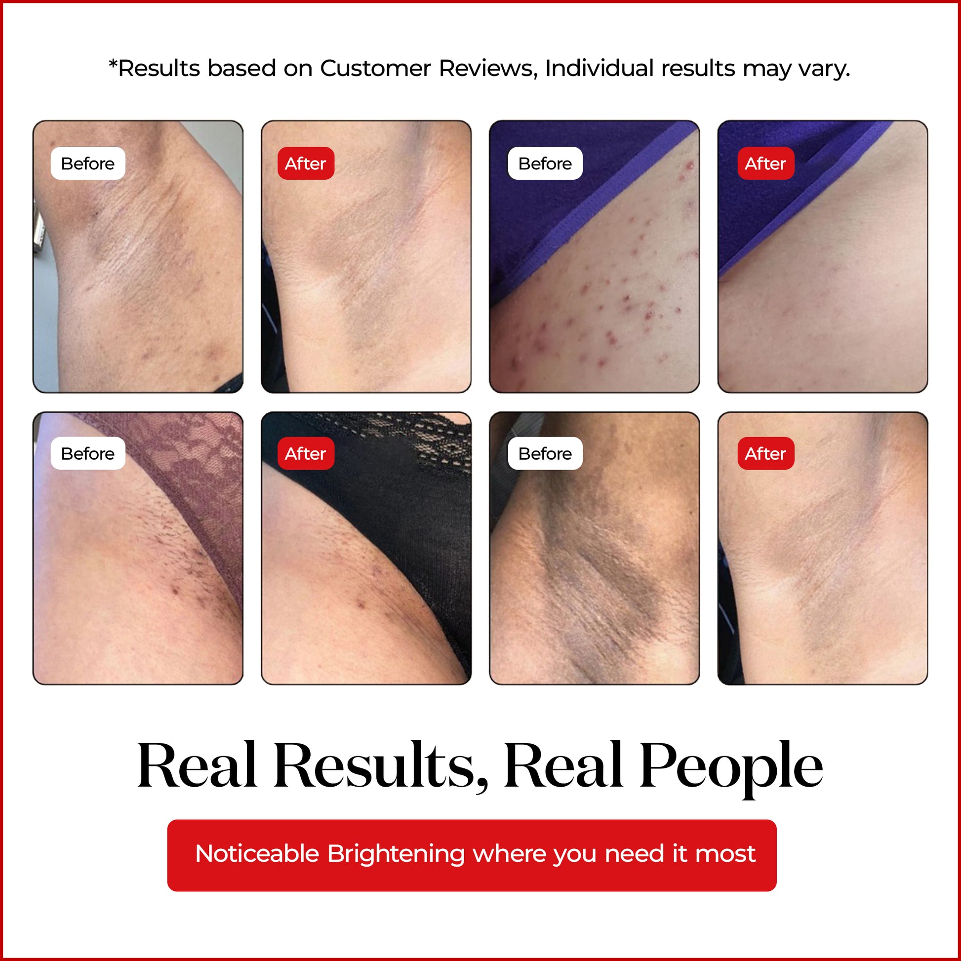 Fade Dark Spots Fast